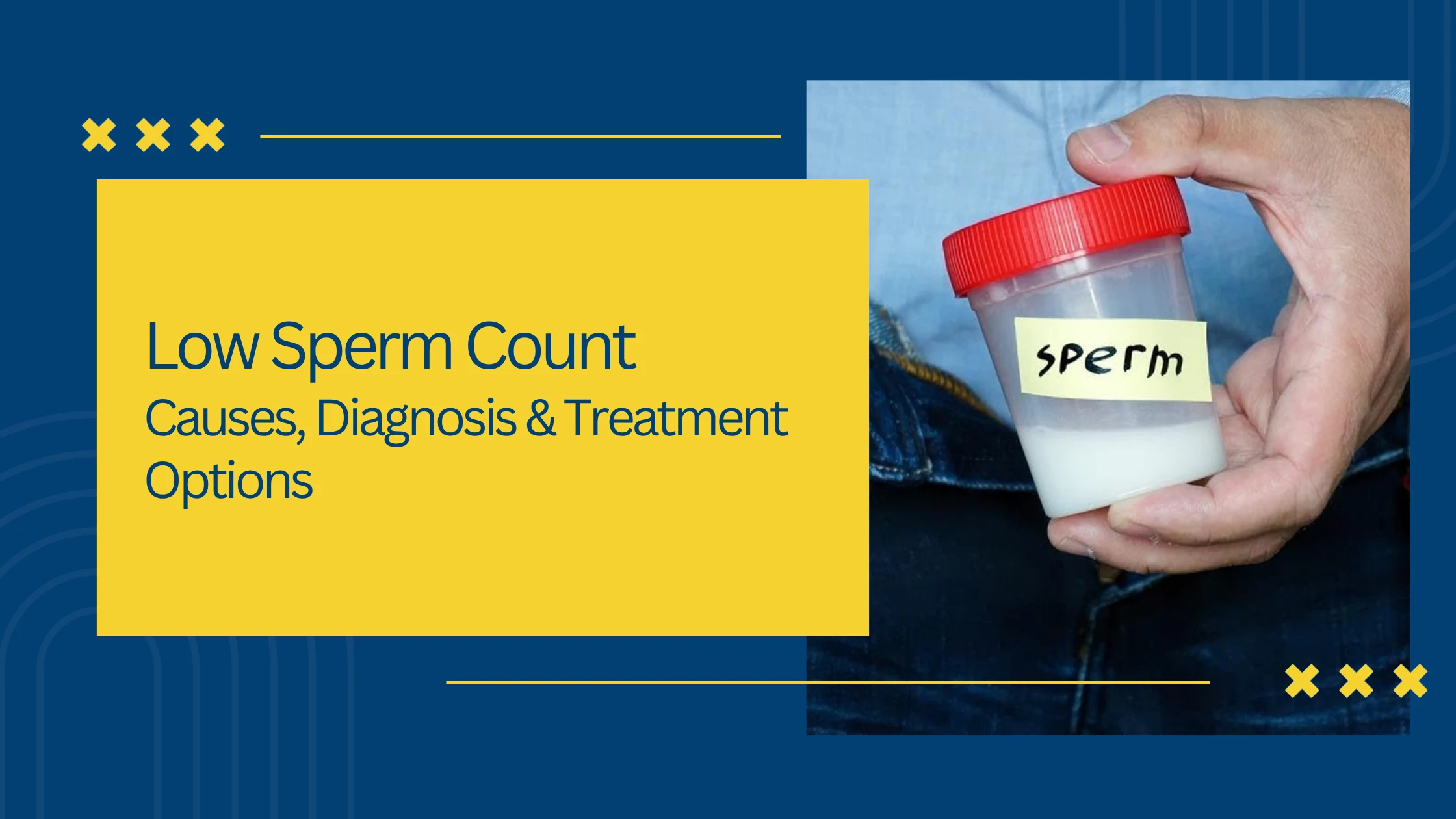 Low Sperm Count: Causes, Diagnosis & Treatment Options